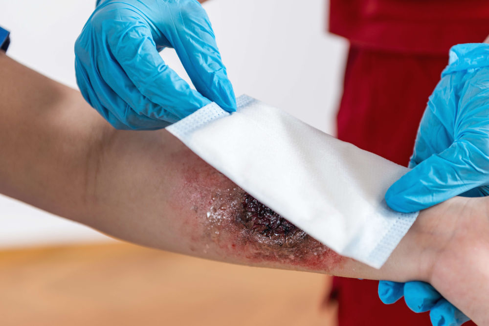 Healing wounds with nutrition